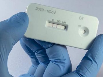 Anti Body Test kit